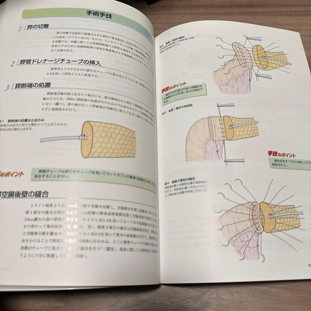 吻合術と縫合術 : ワンランクレベルアップのために