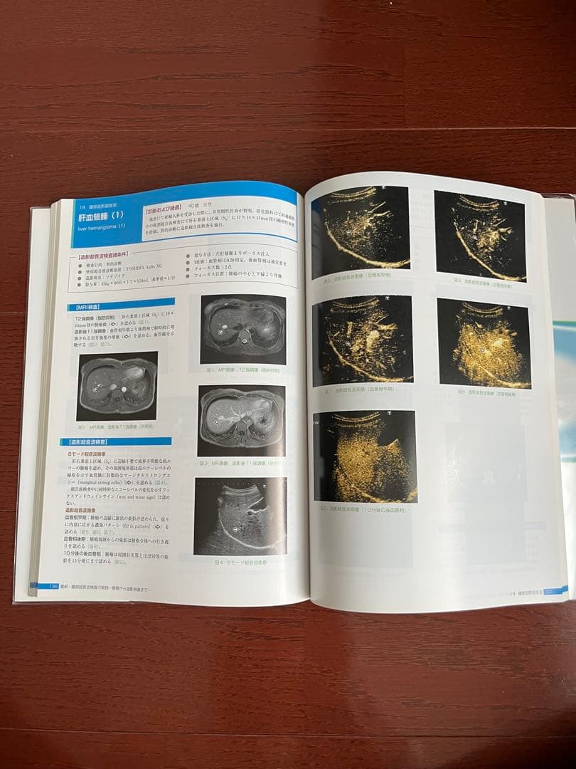 【腹部超音波検査の実践基礎から造影検査まで】 【はじめての超音波検査第2版】