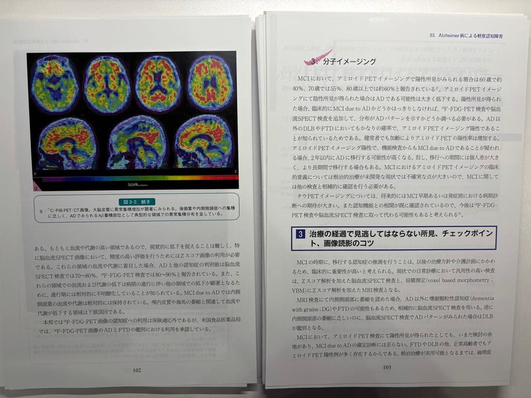 ☆裁断済み☆こう読む認知症原因診断のための脳画像 : 内科系と脳外科の診断流儀