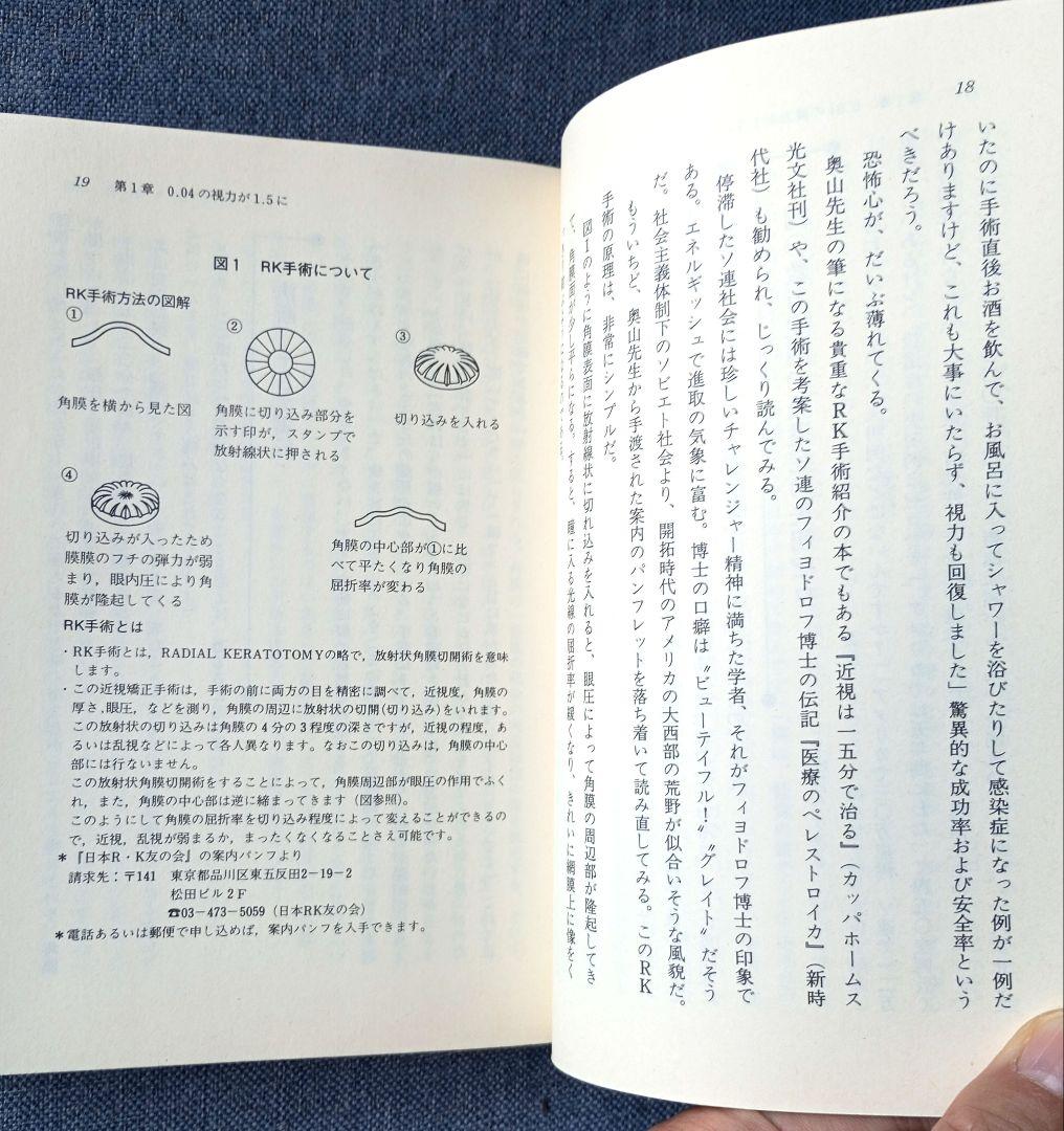 グッドバイ！めがね・コンタクト―１５分のＲＫ手術で近視・乱視が治る
