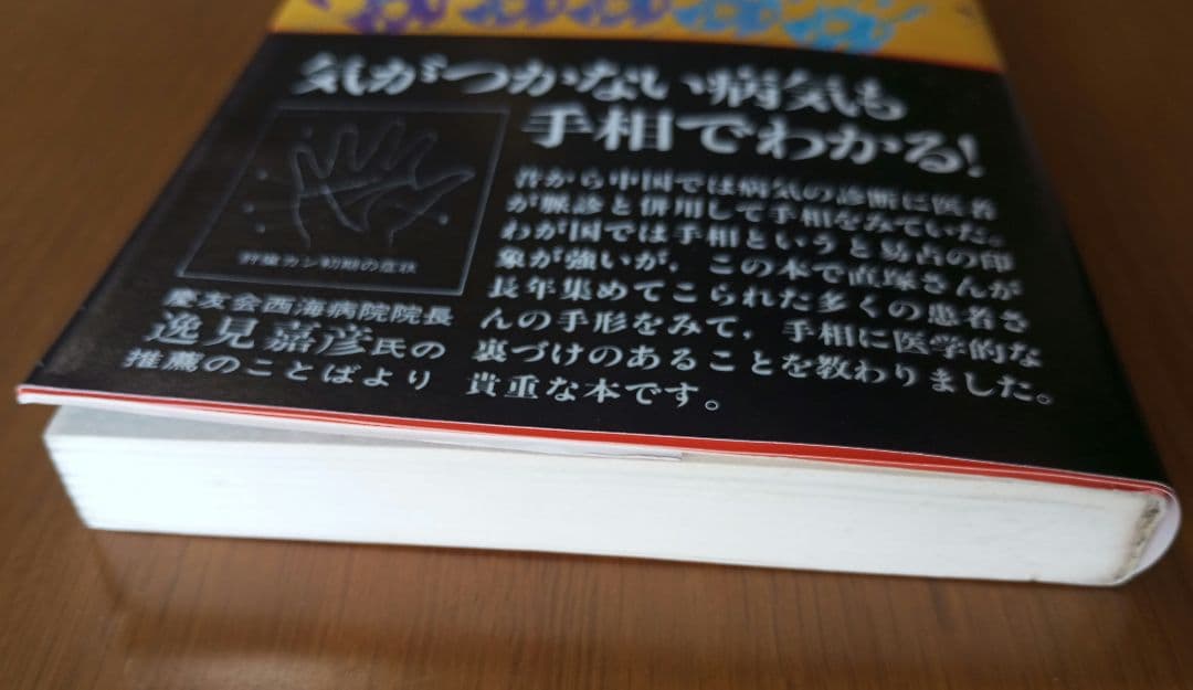 手相で病気を早期発見―患者の手形で実証した