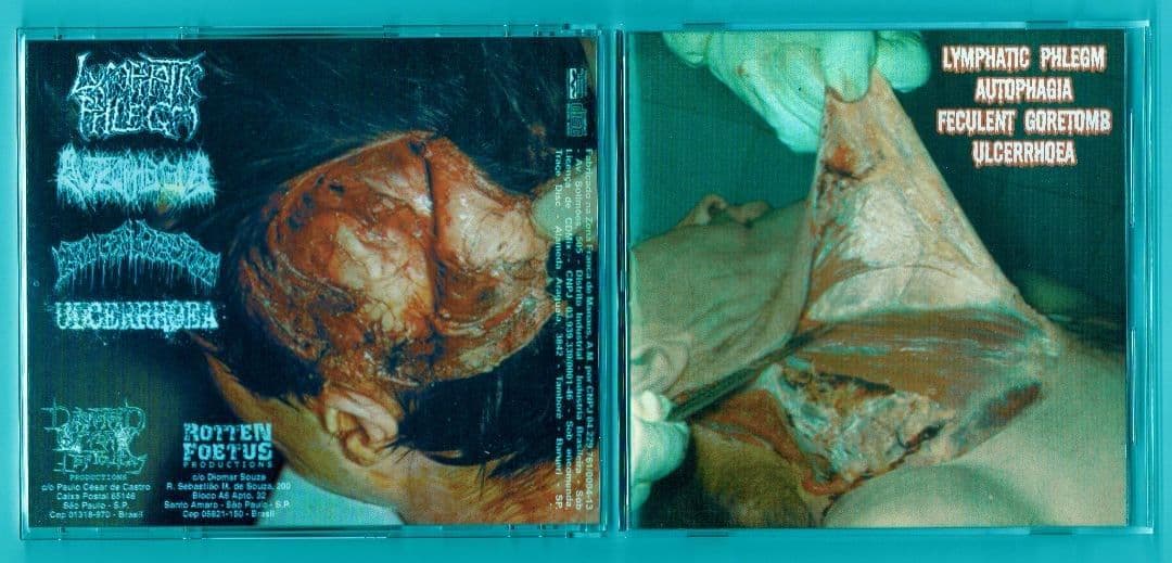 ゴアグライン〇LYMPHATIC PHLEGM 02年4-Way Split