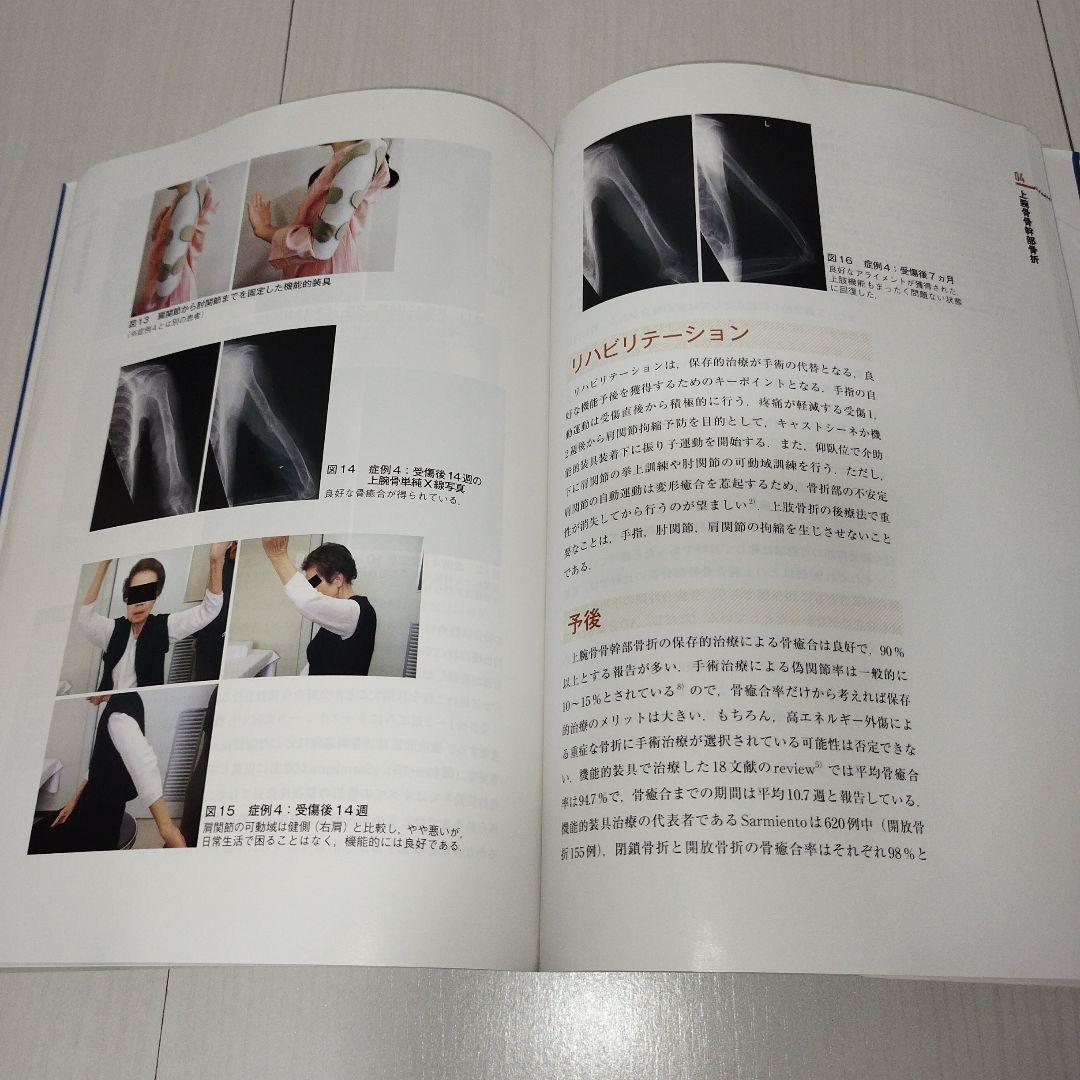 Y0986 骨折の保存的治療 日常診療の疑問に答える 保存的治療