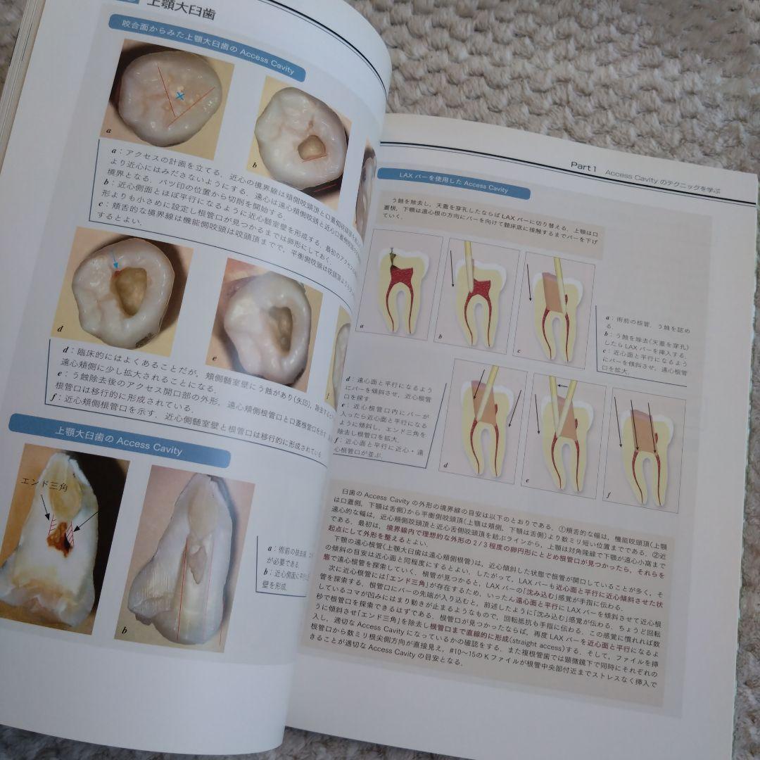 健康・医学 How to Endodontics The State of the Art