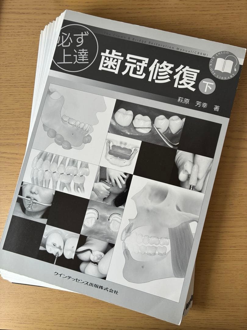 【裁断済】必ず上達歯冠修復 上下巻セット