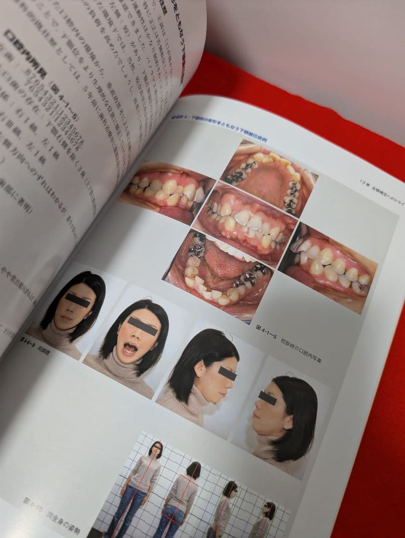 あなたもスーパー矯正ドクター 菊池武芳 本 歯科