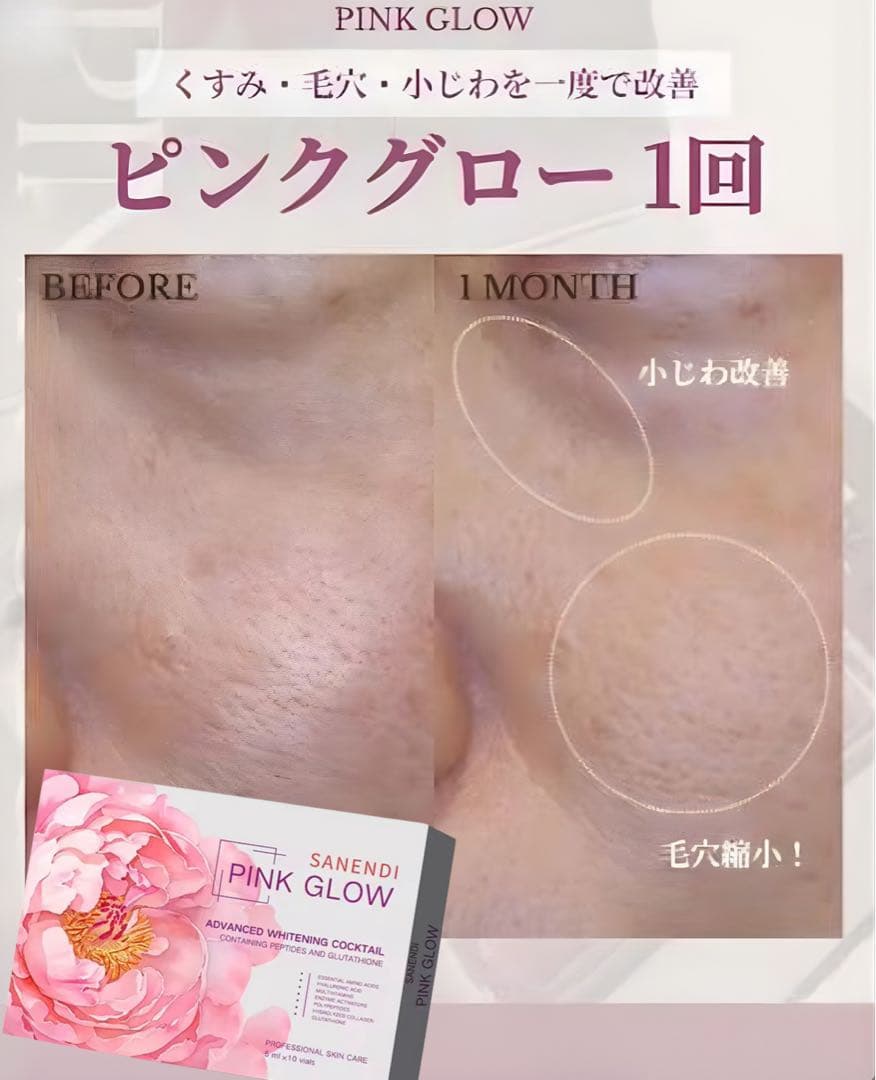 たえみ　ピンクグロー