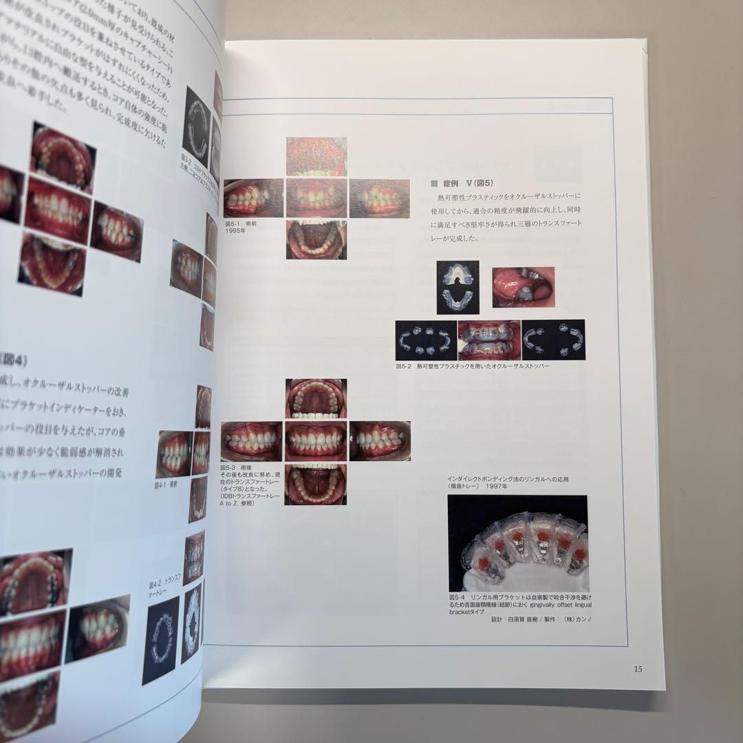[値下げ可能] プラケットポジショニング 解釈と実際