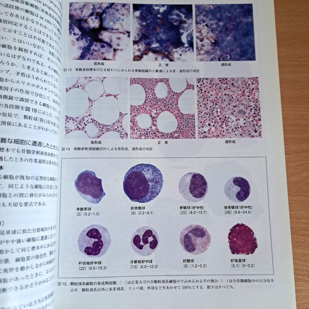 血液細胞アトラス