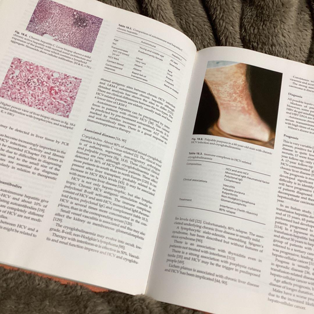 洋書 Diseases of the Liver and Biliary System