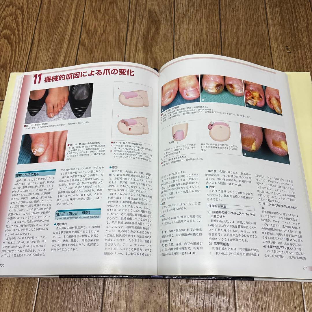 【爪】基礎から臨床まで 東禹彦(ヒガシノブヒコ