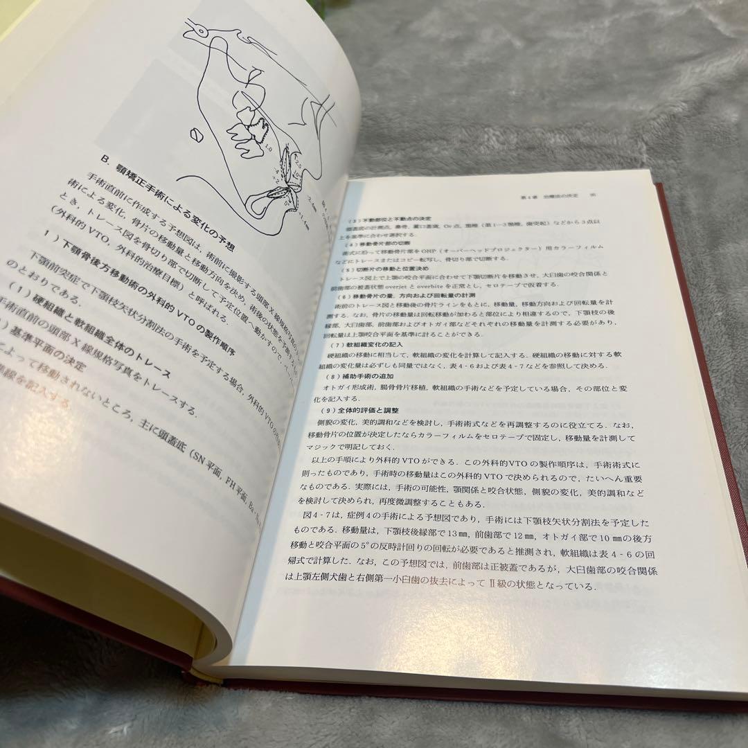 顎顔面変形症の外科的矯正治療