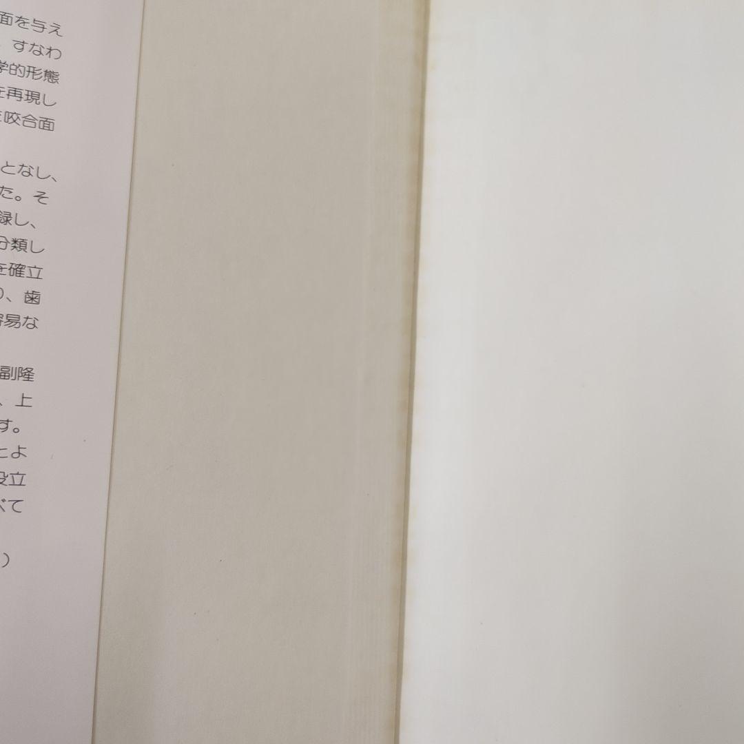 アナトミカル日歯咬合面形成法