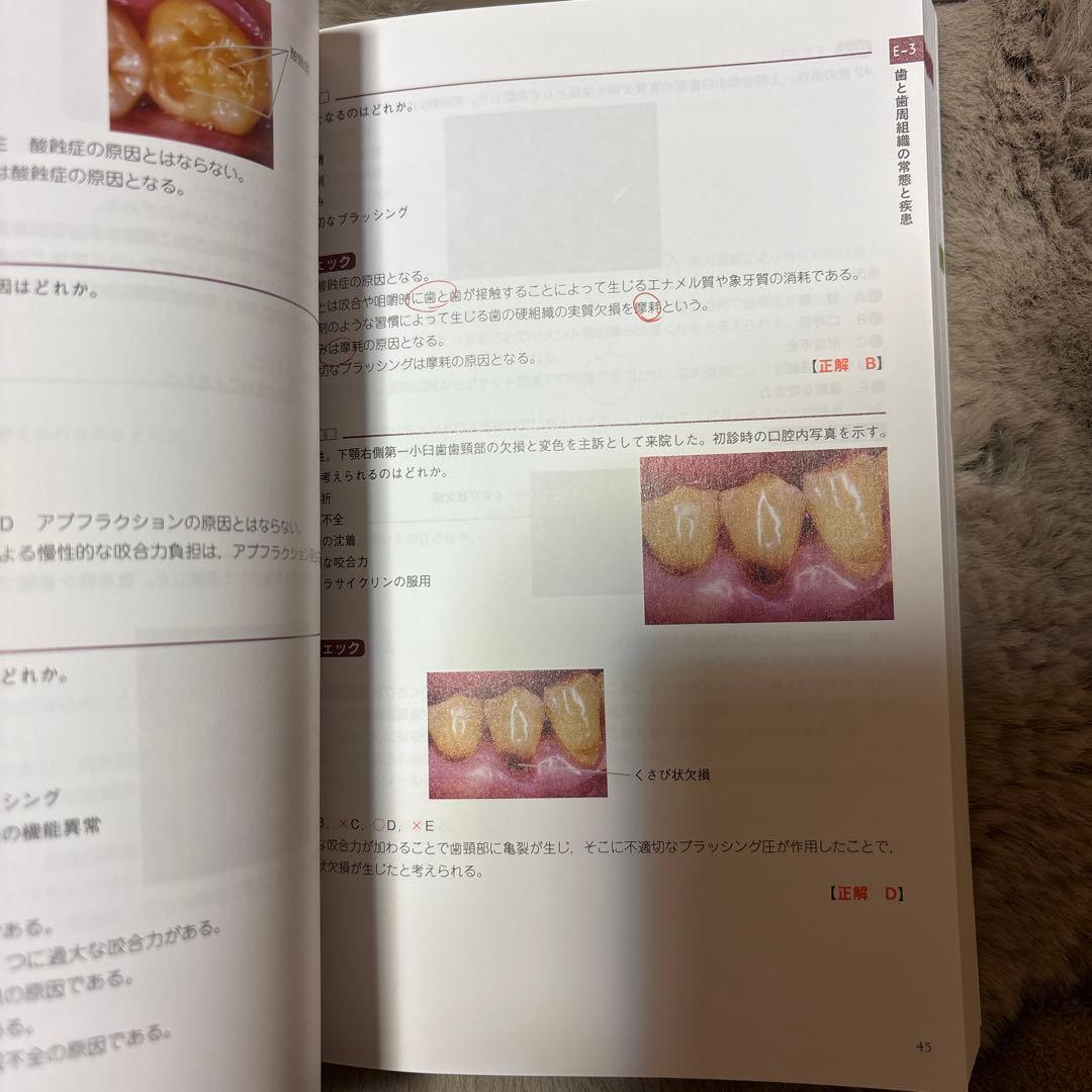 CBTANSWER歯科CBT対策問題集 アンサー DESS cbt pass