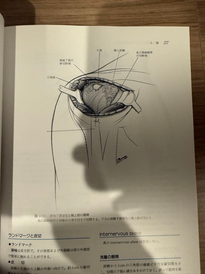 整形外科医のための手術解剖学図説 第2版