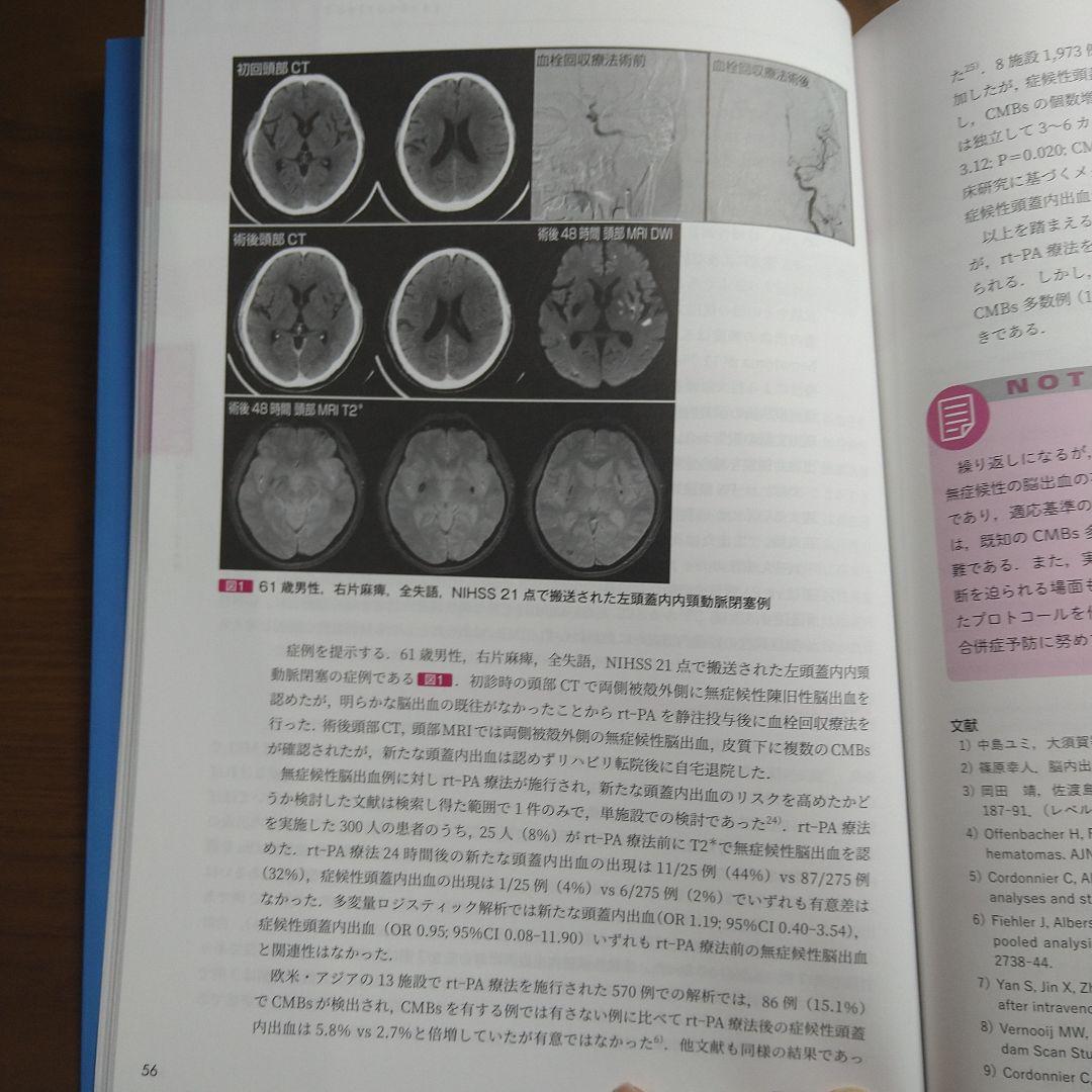 脳卒中治療 Controversy