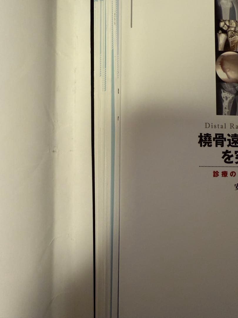 裁断済み　橈骨遠位端骨折を極める　診療の実践A to Z