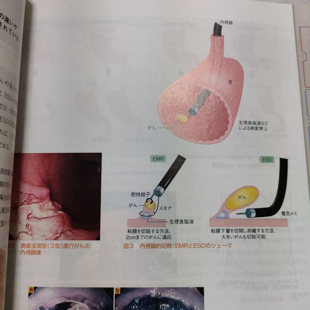 ★看護★消化器の本　4冊セット★