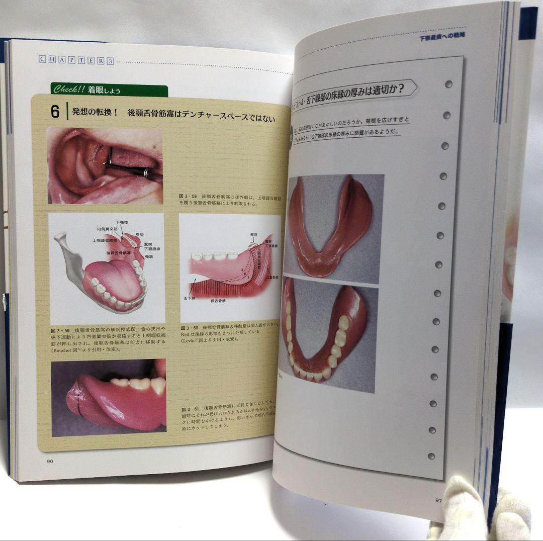【本】　よい義歯だめな義歯 コンプリートデンチャー17のルール　鈴木哲也著