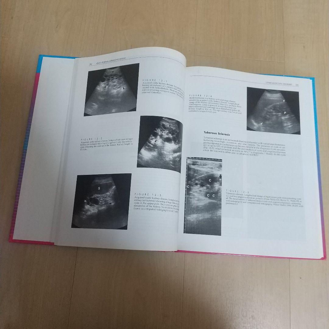 健康・医学 ATLAS OF Renal Ultrasonography O'NEILL
